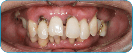 Before image
